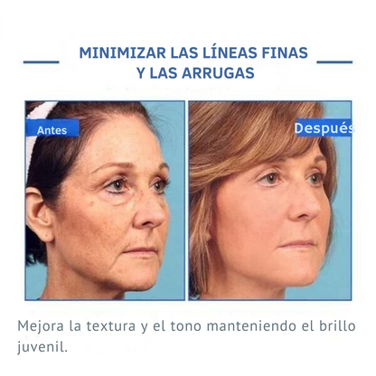 Suero facial Botox