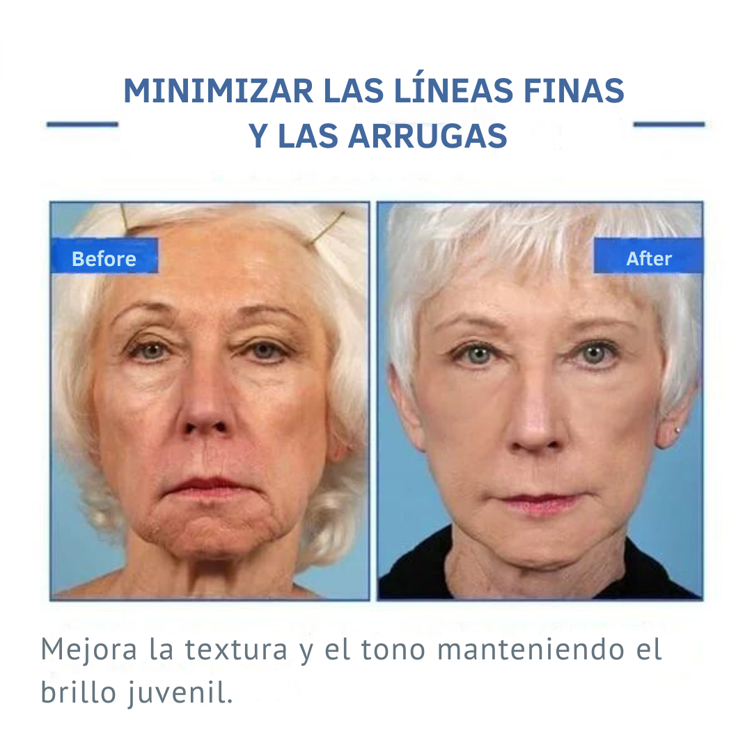 Suero facial Botox