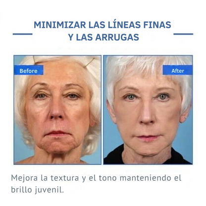 Suero facial Botox