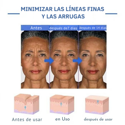 Suero facial Botox